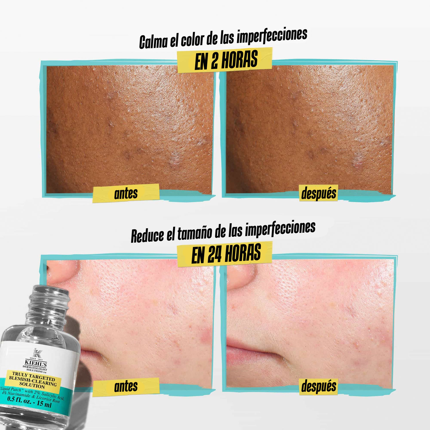 TRULY TARGETED BLEMISH CLEARING SOLUTION (TRATAMIENTO LÍQUIDO PARA IMPERFECCIONES)